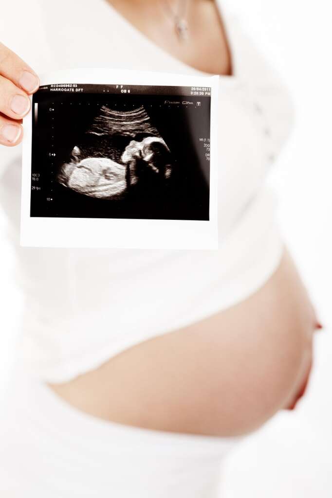 Fotografía de una madre mostrando la ecografía de su bebé.