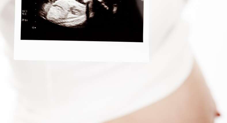 Mujer embarazada representando los derechos del no nacido.