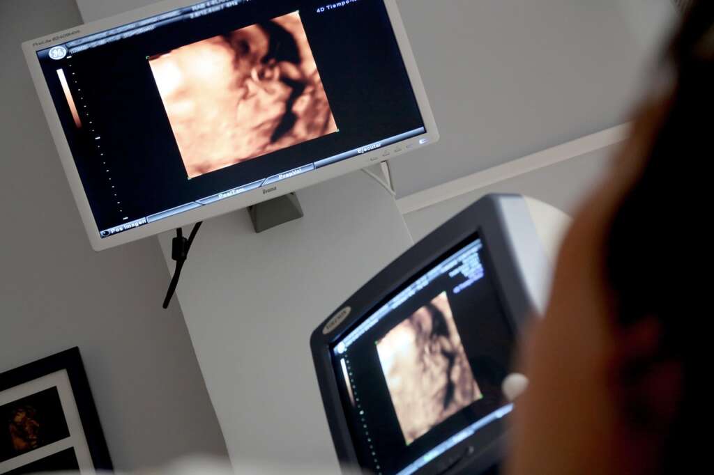 Imagen de ultrasonido mostrando a un bebé en gestación.